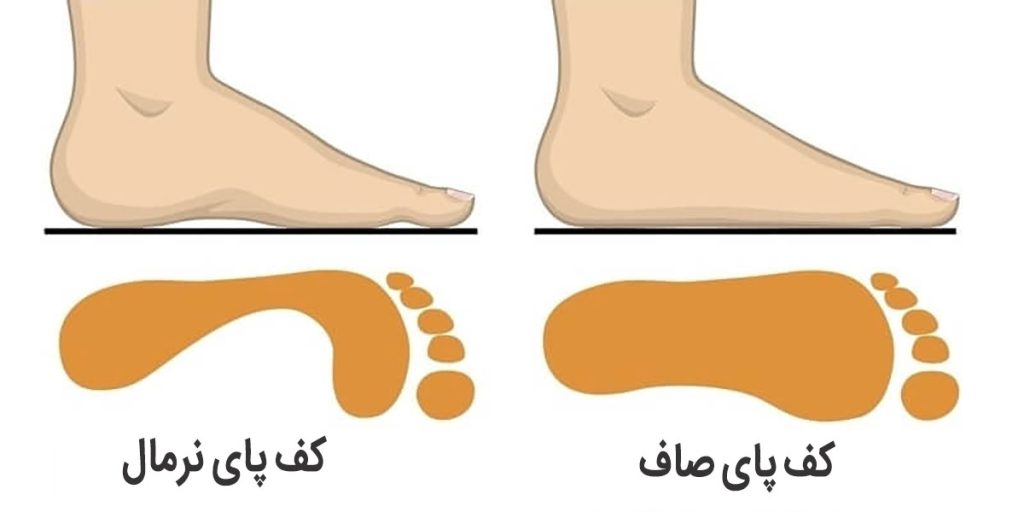 صافی کف پا