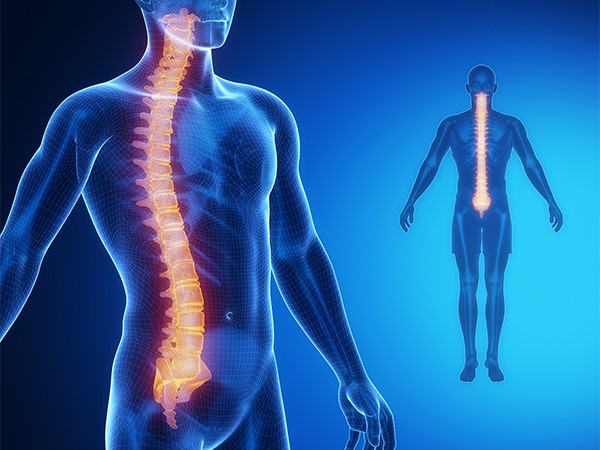 انحراف ستون فقرات و روش های درمانی